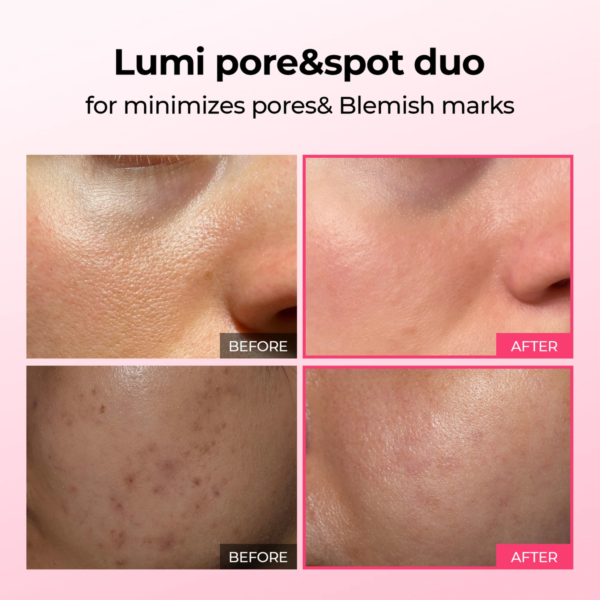 Lumi firm & lift Duo